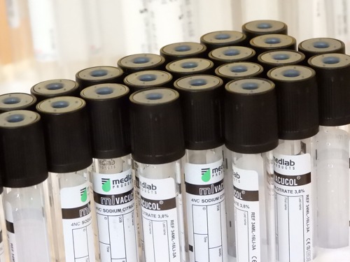 Újra számítanak a koronavíruson átesettek vérére