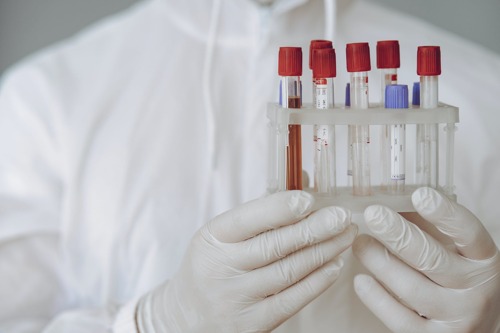 Operatív törzs: remélhetőleg sikerült elkerülni az exponenciális növekedést