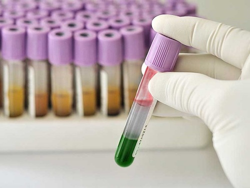 OVSZ: Még több, a koronavírus-fertőzésből kigyógyult ember vérplazmájára van szükség