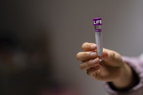 Emmi: sikeresek a vérplazmás kezelések a László-kórházban