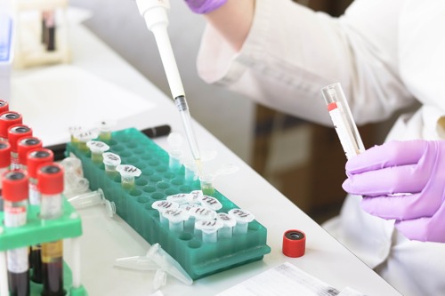 Mesterséges intelligenciával szűri ki a koronavírusos fertőzötteket egy új magyar tesztmódszer