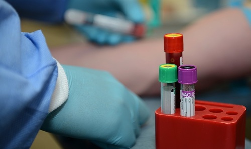 Merkely Béla: A PCR-teszt adatai nagyon jók, de a járványveszély nem múlt el